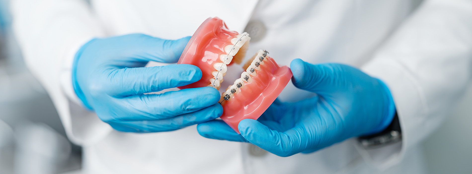 A dental professional holding a red toothbrush with bristles in a blue glove.