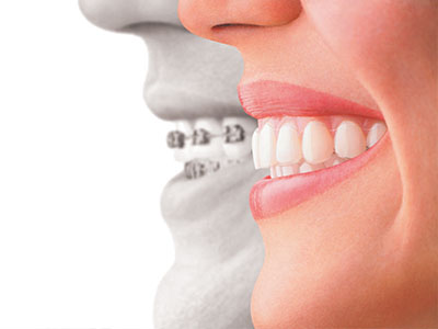 Inspirational Smiles Orthodontics | TMJ Disorders, Interceptive Orthodontics and Orthodontics For Teens