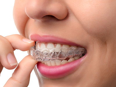 Inspirational Smiles Orthodontics | Sleep Apnea, Traditional Metal Braces and Orthodontic Records