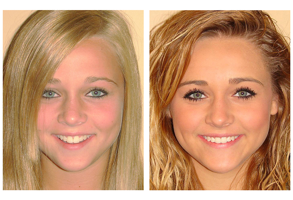 Inspirational Smiles Orthodontics